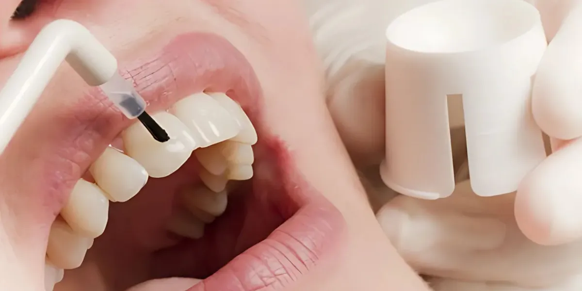 fluoridierung-pzz-zahnarzt-muenchen Fluoridierung